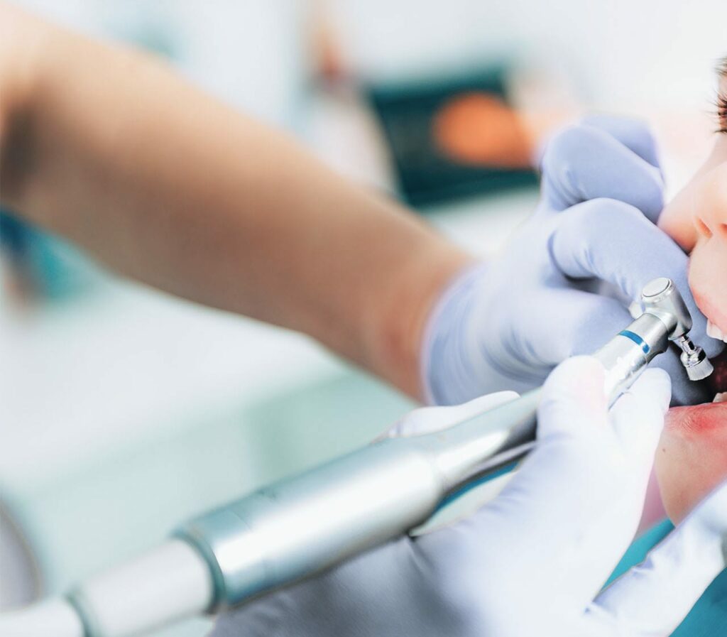 a kid getting his teeth polished